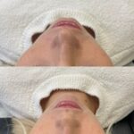 facefiller