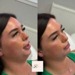 facefiller1