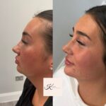 facefiller3