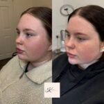 facefiller5