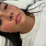 lipfiller10